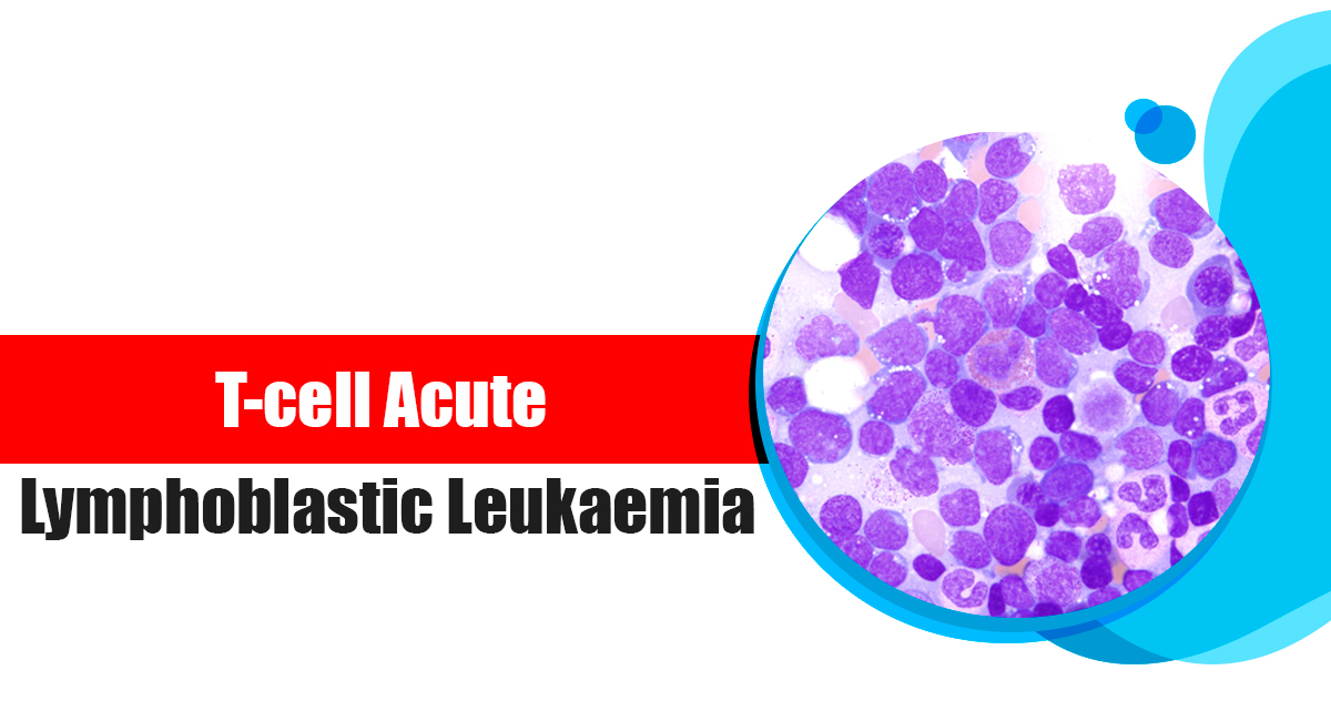 All about T-cell Acute Lymphoblastic Leukaemia