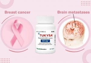 tuksya brain-metastases