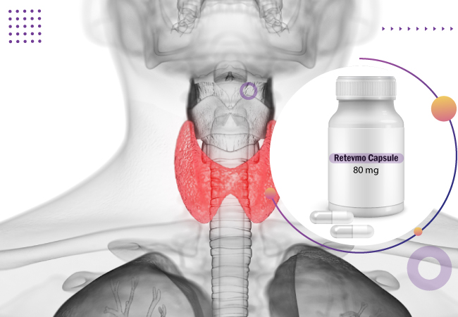 Medullary thyroid carcinoma: Introduction, symptoms, & treatment 