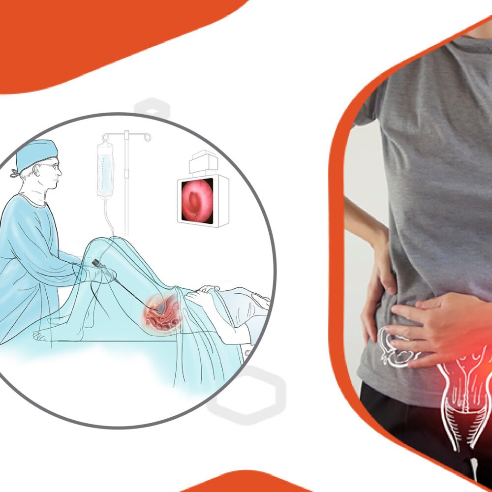 Bladder Cancer Archives - Indian Pharma Network - Buy Prescriptions Drugs