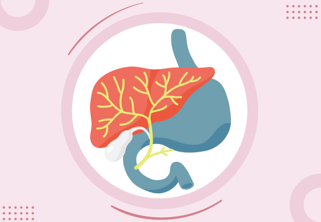 Cholangiocarcinoma