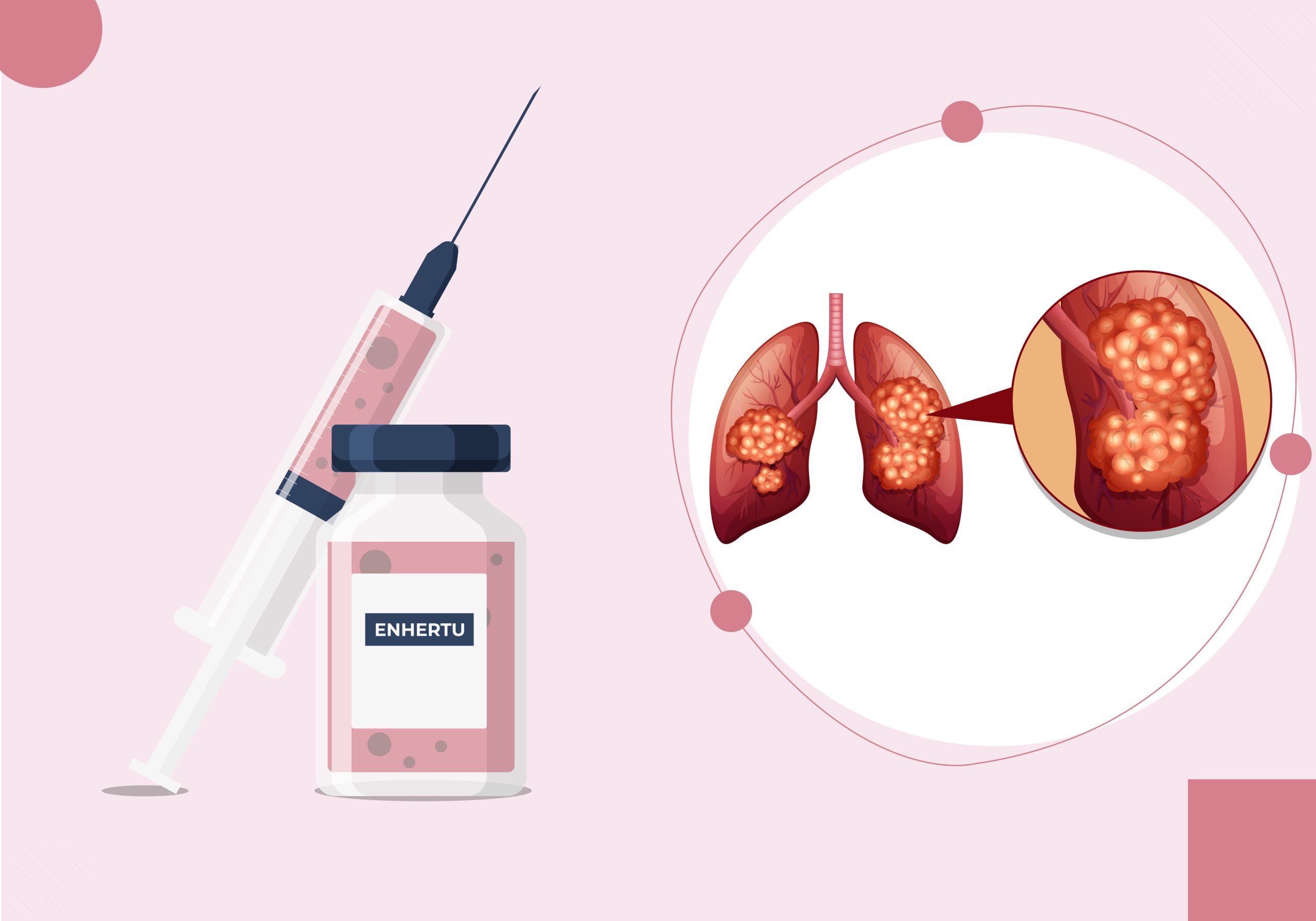 ENHERTU’s Role in NSCLC Treatment and Management