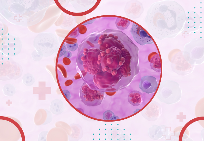 T-Cell Acute Lymphoblastic Leukemia Guidelines