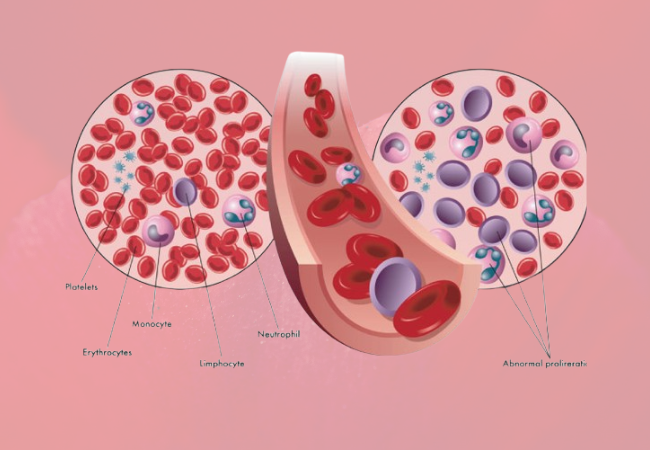 FDA Approves Tibsovo: Myelodysplastic syndromes a rare form of blood cancers