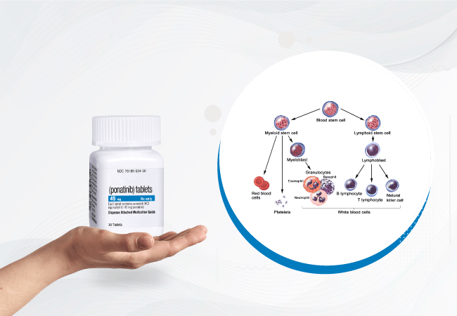 Ponatinib Shines as Induction Therapy in Chronic Phase CML