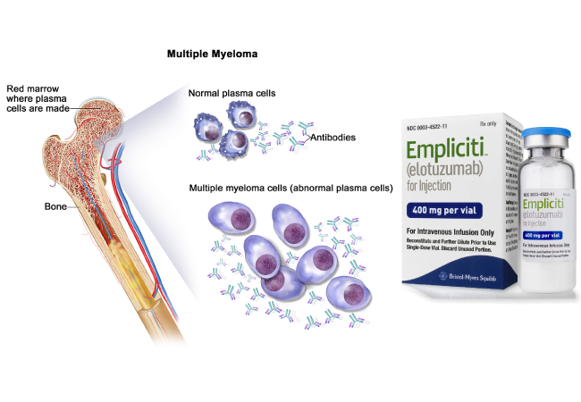 First SLAMF7 Antibody Therapy for Previously Treated Multiple Myeloma