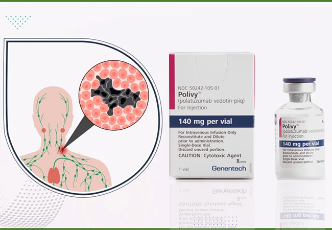 Understanding High Grade B-Cell Lymphoma (HGBL) and Its Novel Treatment Polivy