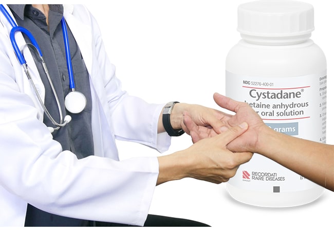 Cystathionine Beta-Synthase (CBS) Deficiency: Prevalence, Symptoms, and Treatment