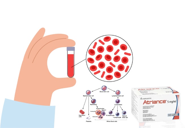 T-ALL vs. T-LBL: Decoding the Twin Threats in Blood Cancers
