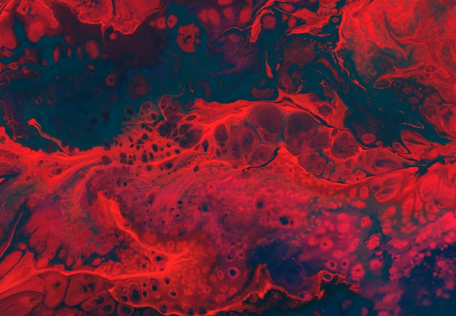 Understanding Hemophilia: A Rare Blood Disorder