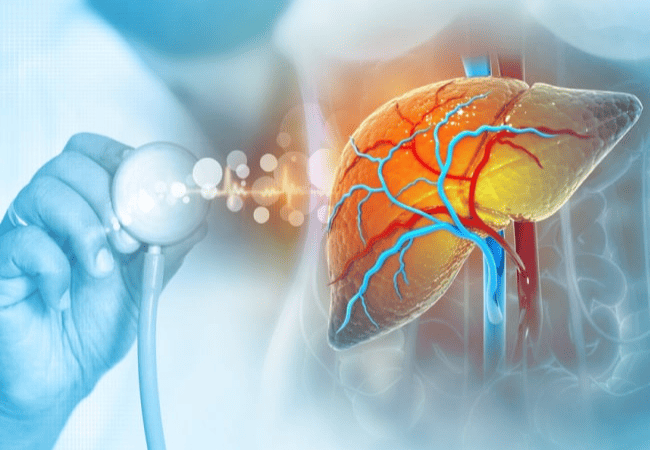 Primary Biliary Cholangitis (PBC): Symptoms, Causes, and Treatment