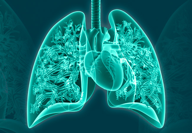 Pulmonary Arterial Hypertension (PAH): Types of Medicines