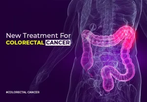 colorectal cancer treatment
