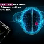 Brain Metastasis: Symptoms, Diagnosis, and Treatment