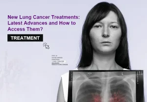 New Lung Cancer