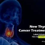 Latest Thyroid Cancer Treatments | Indian Pharma Network
