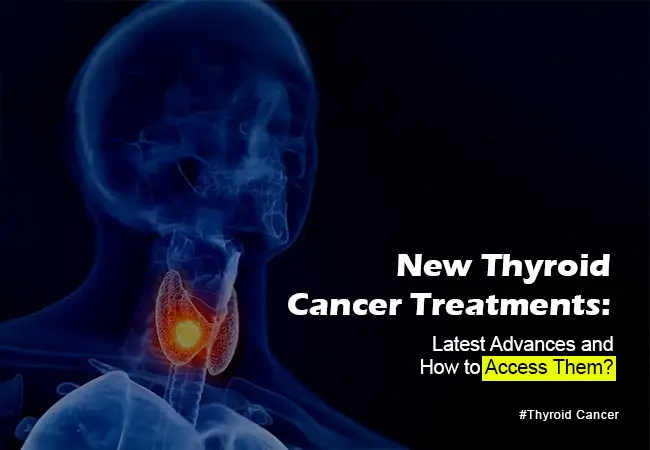 New Thyroid Cancer Treatments: Latest Advances and How to Access Them?