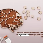 Alzheimer’s Treatment