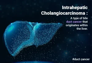 Intrahepatic Cholangiocarcinoma (iCCA)