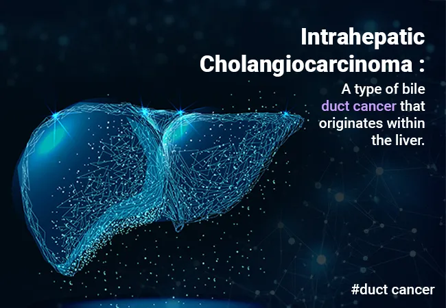 Intrahepatic Cholangiocarcinoma (iCCA)