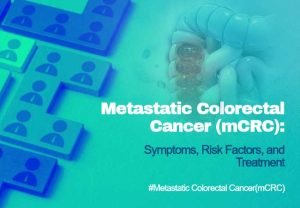 Metastatic Colorectal Cancer (mCRC)