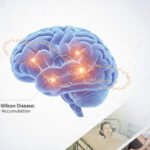 Treatment of Wilson’s Disease