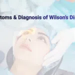 Trientine Capsule for wilson disease