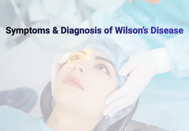 Trientine Capsule for wilson disease