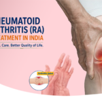Rheumatoid Arthritis