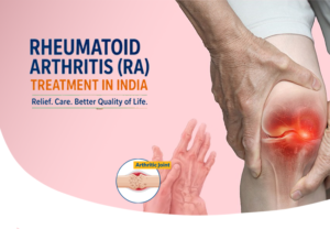 Rheumatoid Arthritis