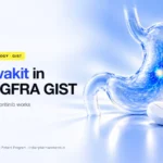 Ayvakit (avapritinib) in PDGFRA exon 18 GIST treatment – Indian Pharma Network