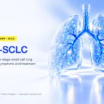 Extensive-stage small cell lung cancer (ES-SCLC) symptoms, causes and treatment – Indian Pharma Network
