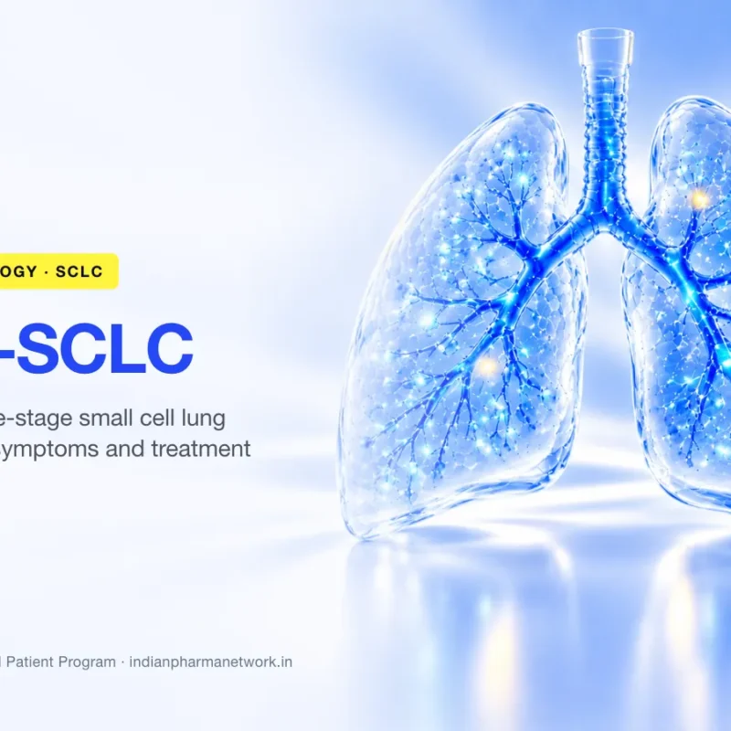 Extensive-stage small cell lung cancer (ES-SCLC) symptoms, causes and treatment – Indian Pharma Network