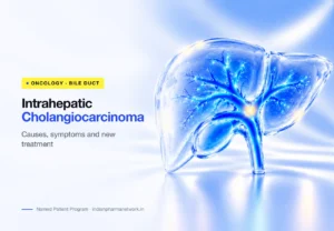 Intrahepatic cholangiocarcinoma (iCCA) causes, symptoms and new treatment – Indian Pharma Network