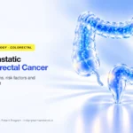 Metastatic colorectal cancer (mCRC) symptoms, risk factors and treatment – Indian Pharma Network