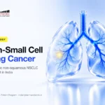 Metastatic non-squamous non-small cell lung cancer (NSCLC) treatment in India