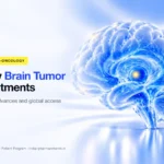 New brain tumor treatments and global access – Indian Pharma Network