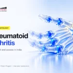 Rheumatoid arthritis (RA) treatment in India – Indian Pharma Network