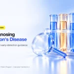 Diagnosis guidance for Wilson's disease – Indian Pharma Network